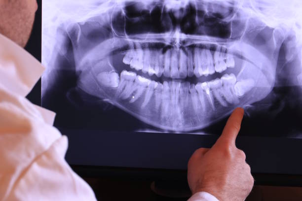 Best Knocked-Out Tooth Emergency  in Lauderdale, MN